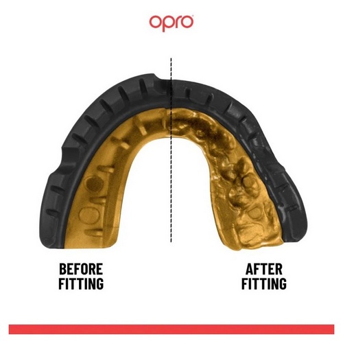 Opro Ochraniacz szczęki na aparat Gold Braces UFC